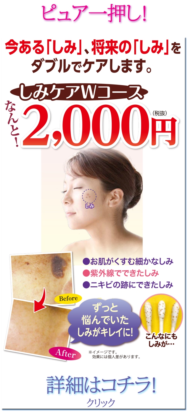 しみケアWコース2000円/奈良のエステはピュア