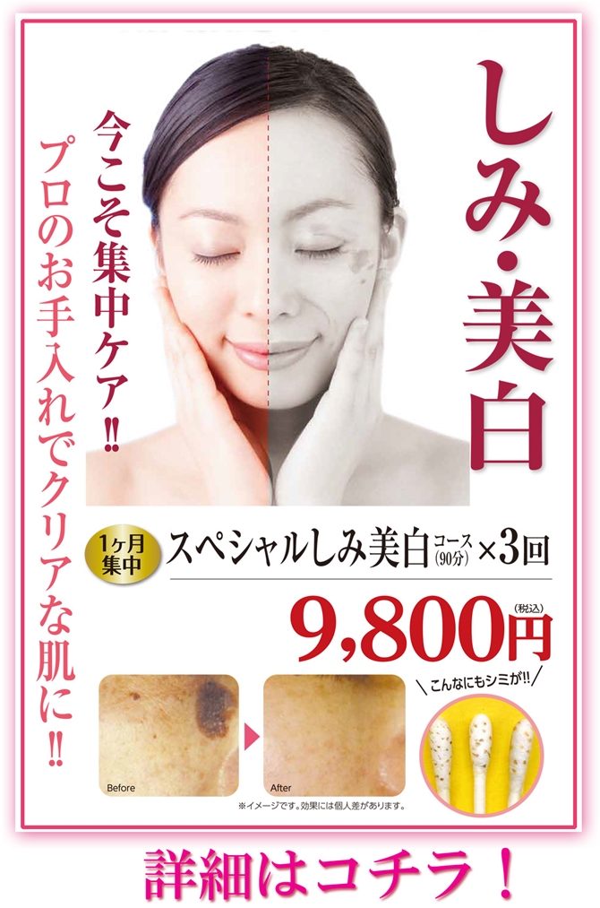 「1ヶ月集中 しみ美白徹底コース9,800円」はコチラ！/ピュア