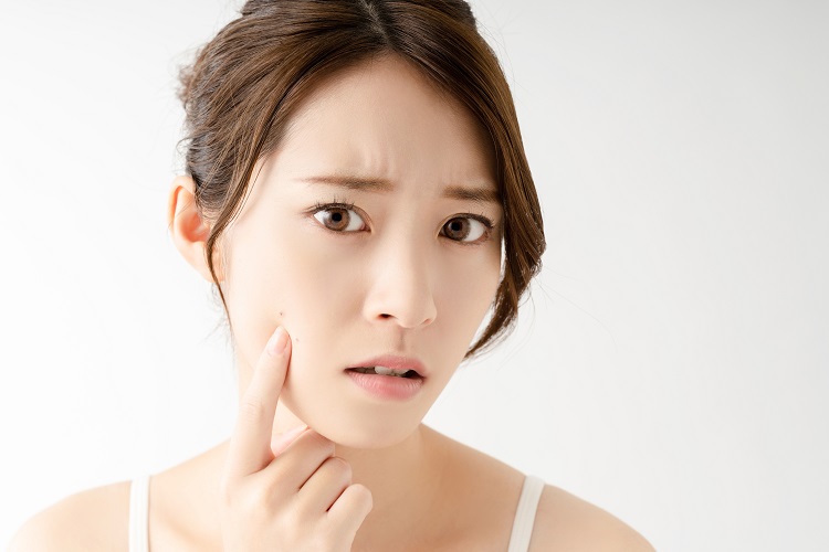 ニキビケアがしたいなら 顔のフェイシャルエステに しみ しわ 美顔専門エステサロンピュア 奈良7店舗